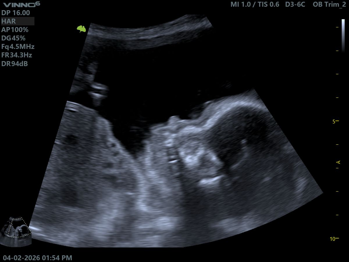 2D General Scan