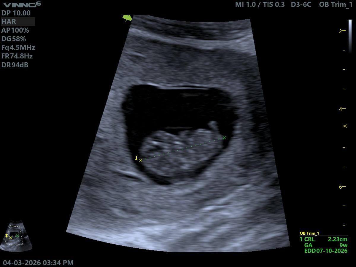 Confirmation Scan